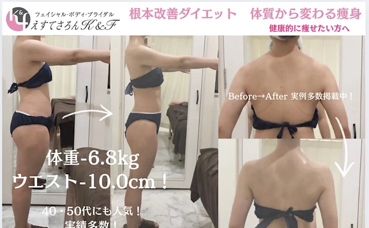 痩身＆ブライダル専門 えすてさろん K＆F 長野店(ソウシンアンド