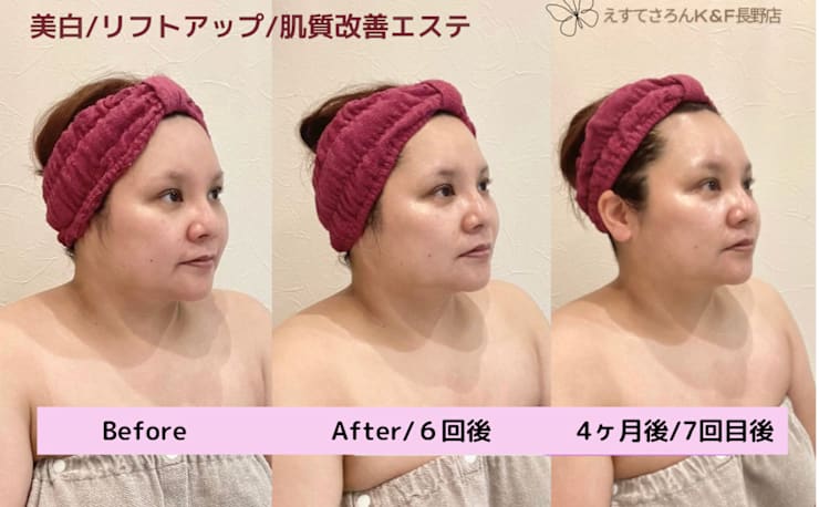 痩身＆ブライダル専門 えすてさろん K＆F 長野店(ソウシンアンド