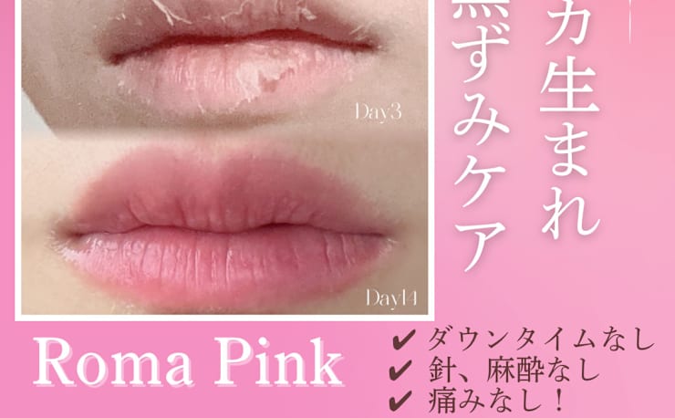 渋谷BELZE【脱毛・毛穴洗浄・フェムケア・ローマピンク】(シブヤ