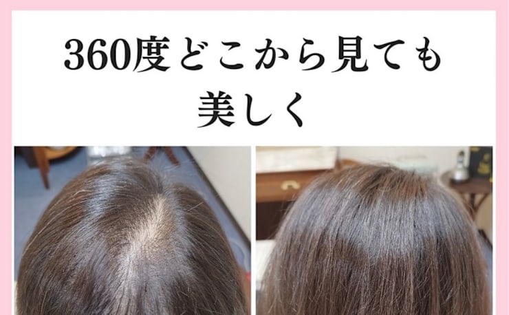増毛エクステ  ケアエク 増毛エクステ【エアエク】をしてとても自然で大満足です！東広島市20代
