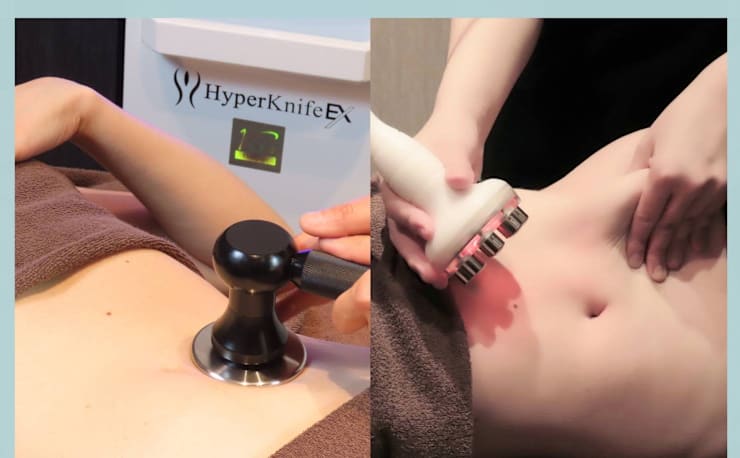 痩身/小顔/美肌専門店】Chou chou恵比寿店-ハイパーナイフEX