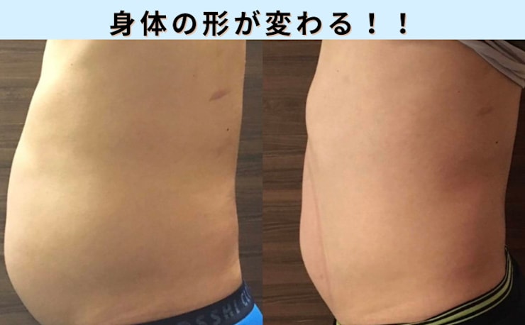 脂肪冷却専門店 Total Studio B-Revolution 秋葉原 上野店(シボウレイ