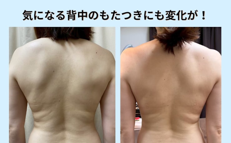脂肪冷却専門店 Total Studio B-Revolution 秋葉原 上野店(シボウレイ