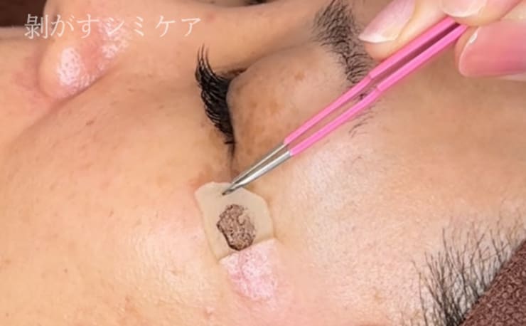 3in1シミケアエステ プリンセスエステティックサロン Couronne(プリンセスエステティックサ