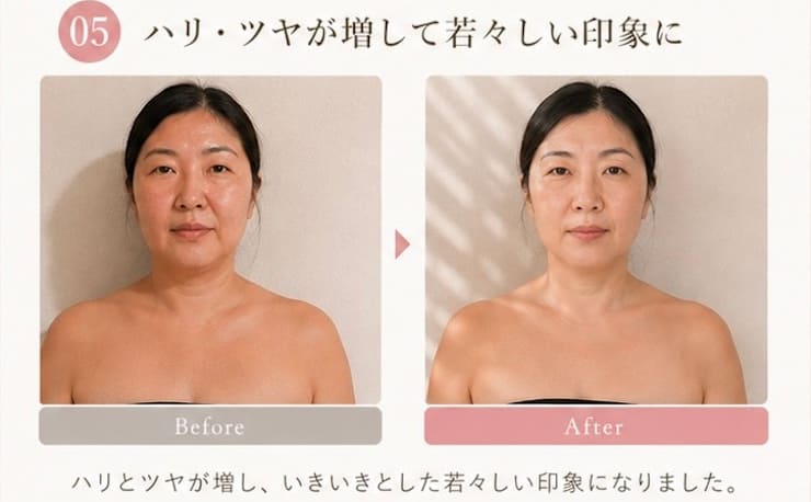 小顔（左右差）矯正・鎖骨出し矯正 専門院 Moreface(モアフェイス)の