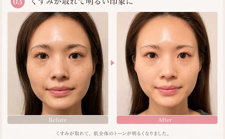 小顔（左右差）矯正・鎖骨出し矯正 専門院 Moreface(モアフェイス)の