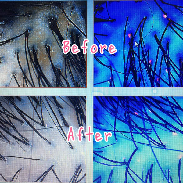 抗酸化エイジング頭皮ケア|髪質改善サロン OHANA