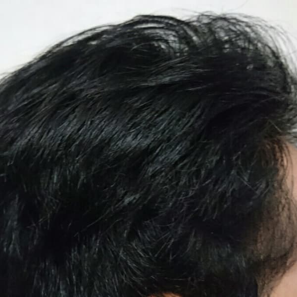 ホントに生えるコースアフター|CROCO