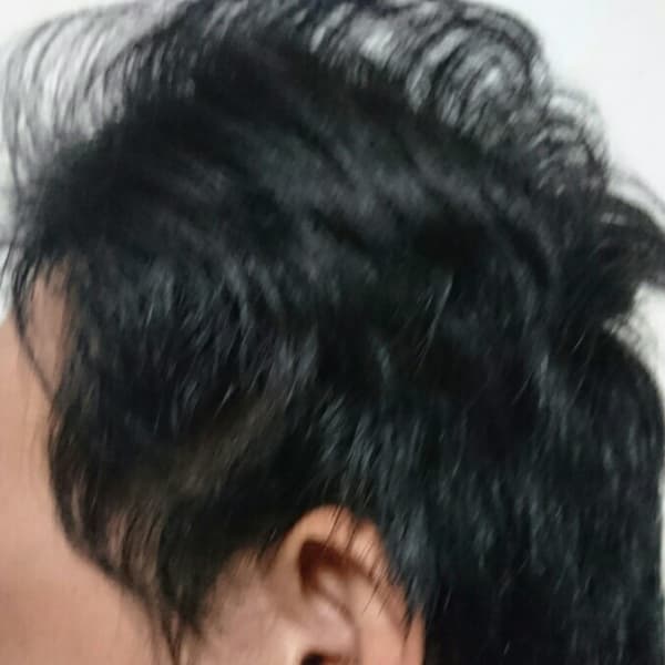 ホントに生えるコースアフター