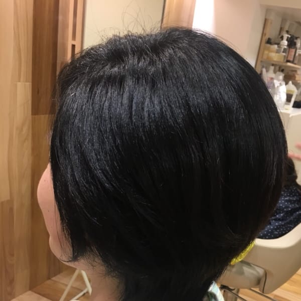 ナチュラル矯正