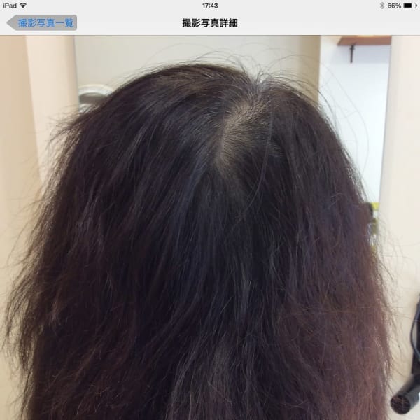 毛髪復元メニュー|twlation