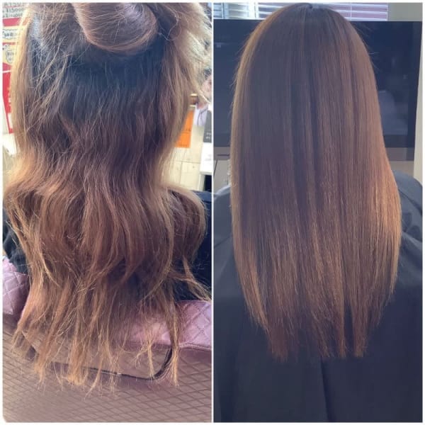 【30歳代】王妃の水エステストレート(施術例)