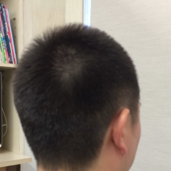 ベリーショート