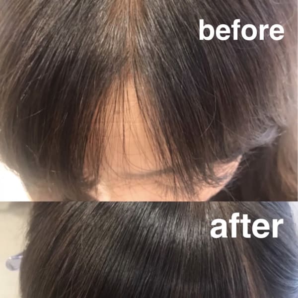 エンジェリックケア