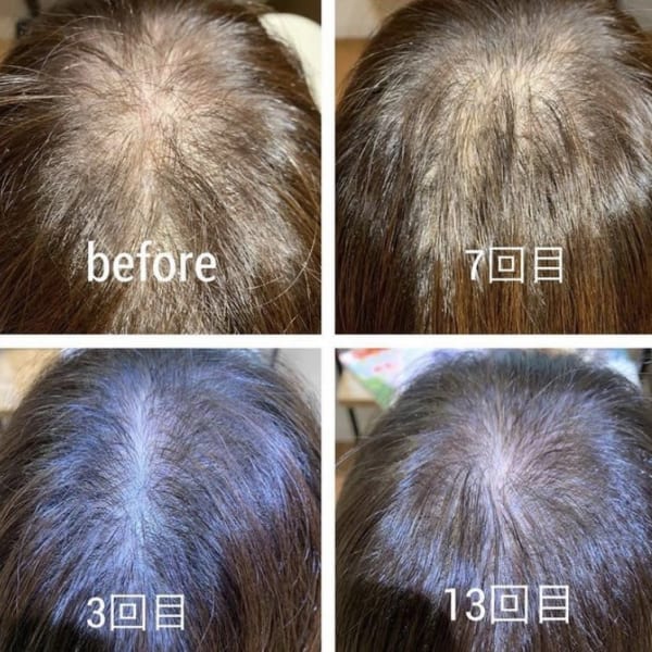 強髪プログラム|サロンドボーテ グランディール