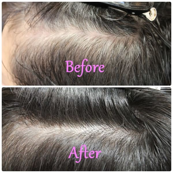 白髪の増化を抑えるあり【薬剤除去カラー】