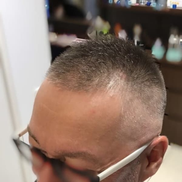 スキンフェード×ボウズ ソフモヒ/