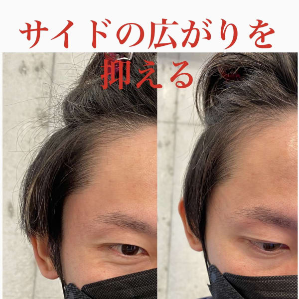 【メンズ必見】韓国式ダウンパーマ