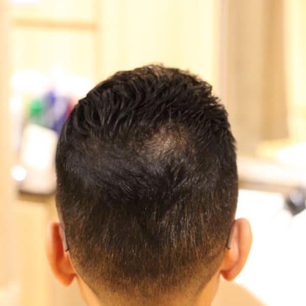 ソフトリーゼント