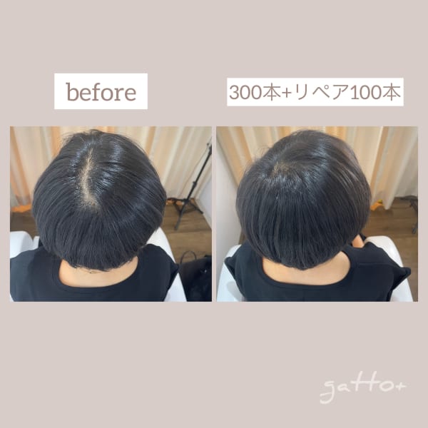 つむじ割れのお悩み