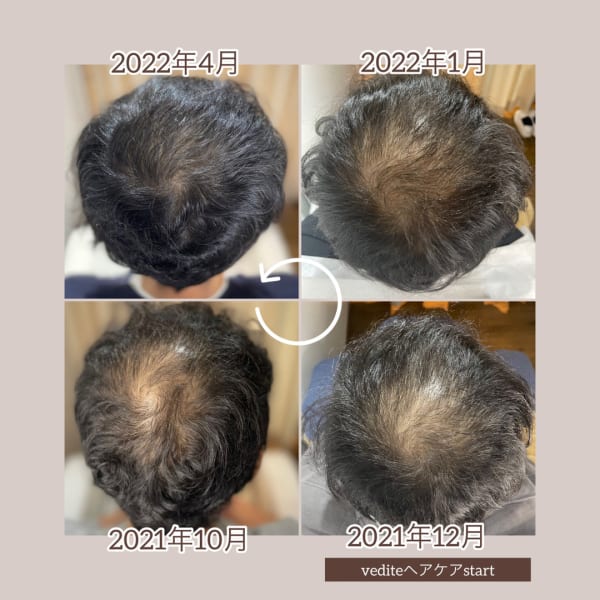 男性40代　トップと前髪のボリュームアップ