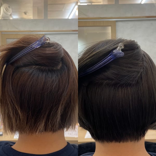 ボリューム矯正