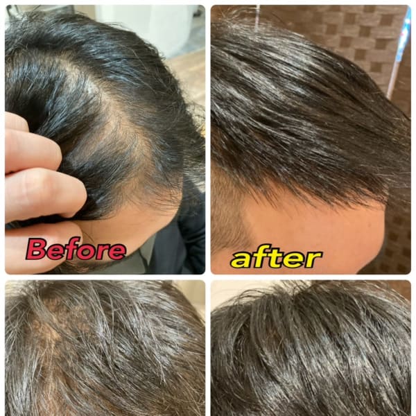 本格発毛育毛コース