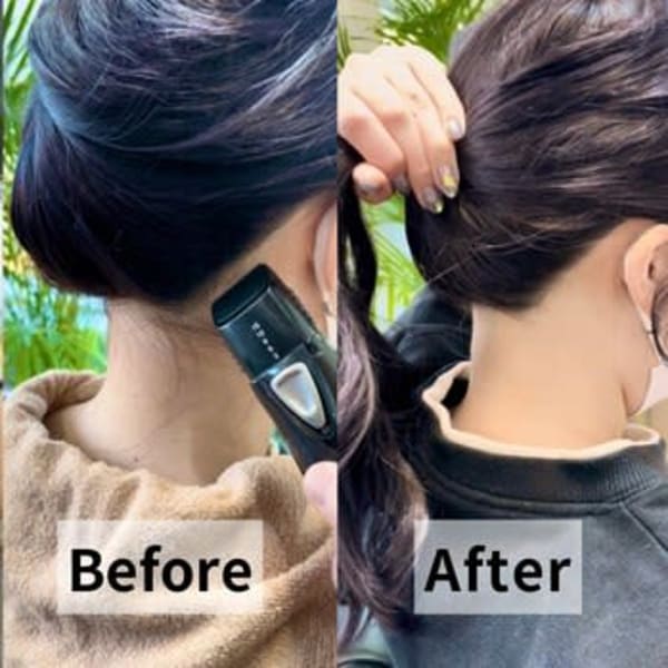 うなじ脱毛|ALICe by AFLOAT