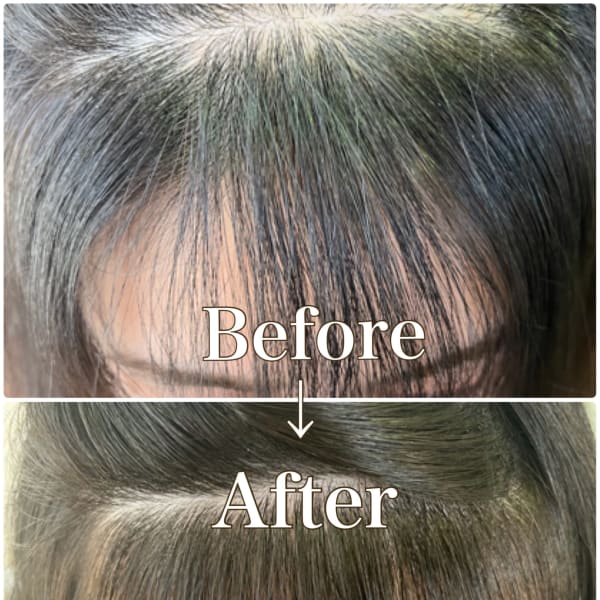 前髪生え癖改善パーマ