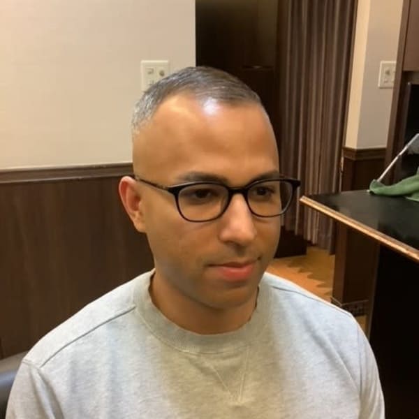 スキンフェード