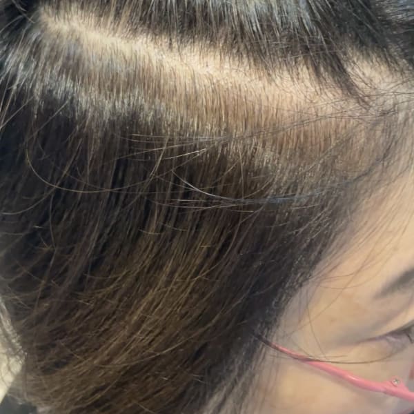 アフター → ビフォア　右にスワイプ【白髪染め/脱白髪染め】