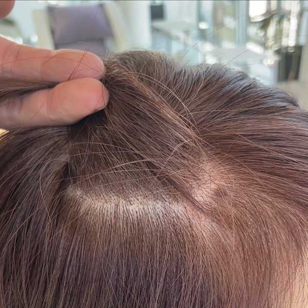 アフター → ビフォア 右にスワイプ【白髪染め/脱白髪染め】