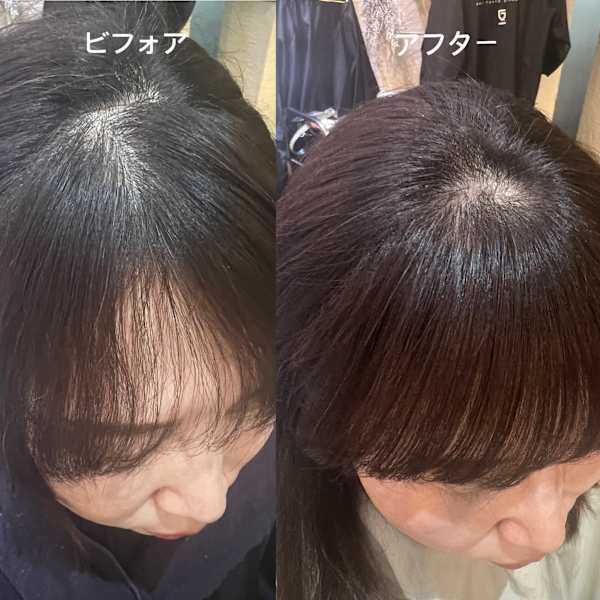 ヘアリセッター