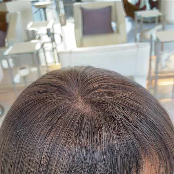 アフター → ビフォア　右にスワイプ【白髪染め/脱白髪染め】