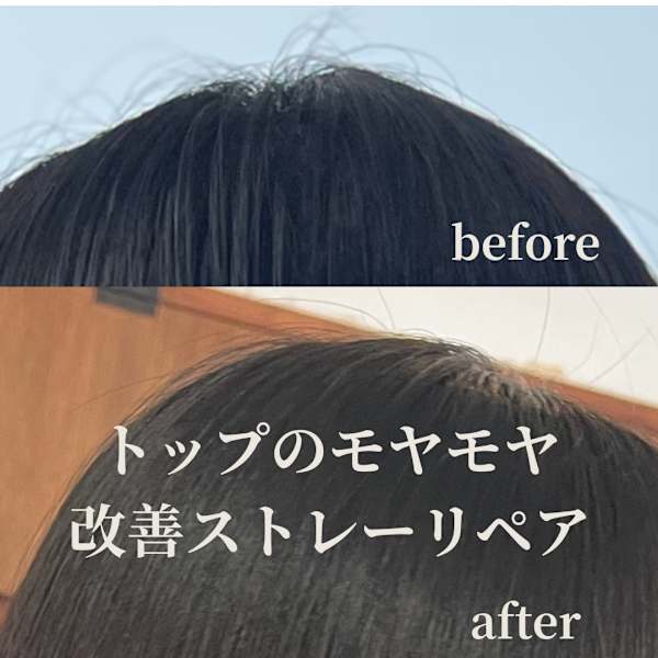 トップのモヤモヤ毛改善！