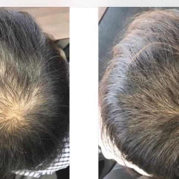 ニコヘアーオリジナル育毛メニュー