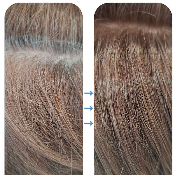 カラーエステ♪白髪ぼかしカラー