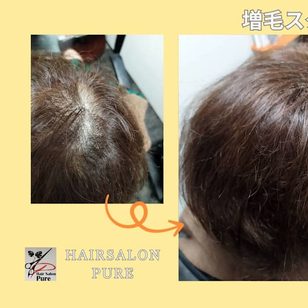 大人のエクステ、ボリュームアップ分け目や渦気にしない!