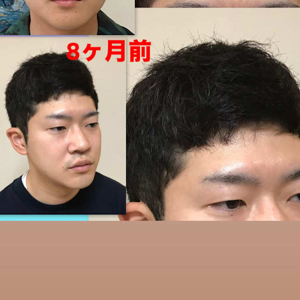 ツーブロックレイヤー