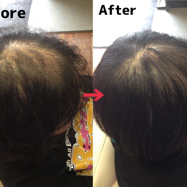 美容院 be shealing×増毛エクステ