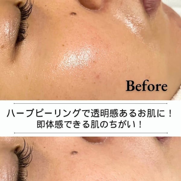 韓国肌管理Belle 西船橋【カンコクハダカンリ ベル ニシフナバシ】のスタッフ紹介。オハダ シラタマハダ