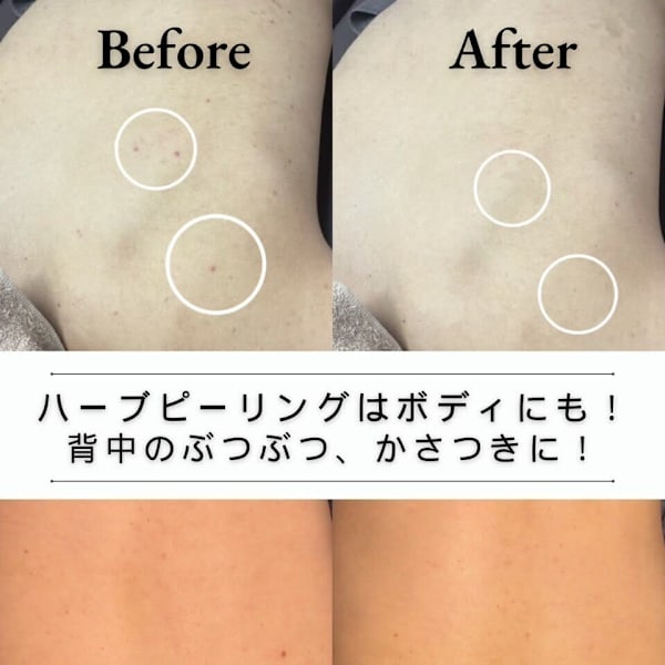 韓国肌管理Belle 柏【カンコクハダカンリ ベル カシワ】のスタッフ紹介。セナカ ニキビケア