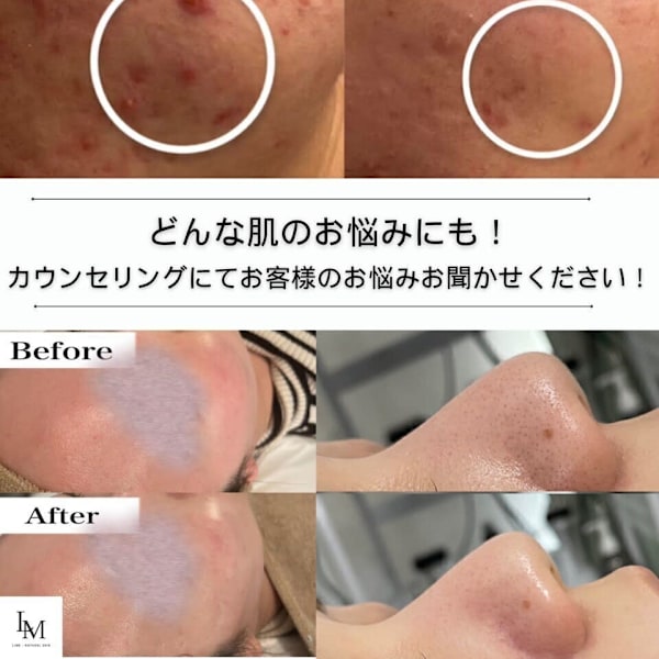 韓国肌管理Belle 柏【カンコクハダカンリ ベル カシワ】のスタッフ紹介。ハダノオナヤミ ゼンカイゼン