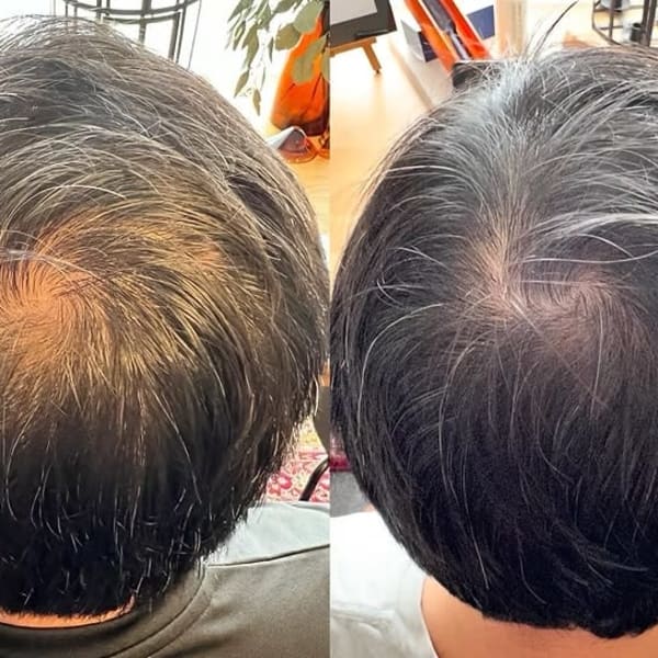 解頭リリース【スペシャル】（シャンプー・ブロー付）