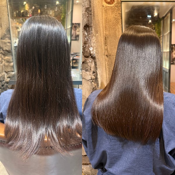 【プロが創る】オーダーメイド矯正