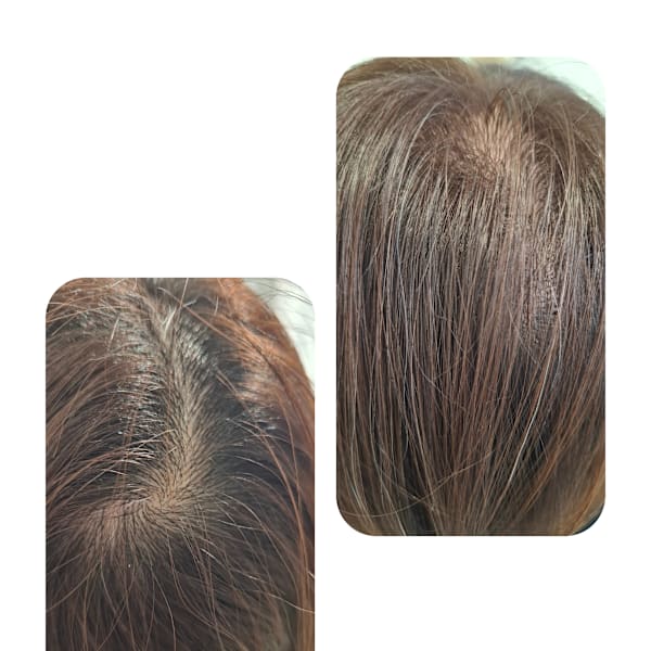 話題のトキカタ♪頭頂部編|Hair & Spa y‐Forme Ginza