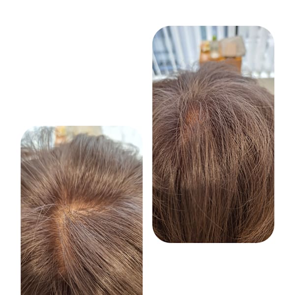 話題のトキカタ♪頭頂部編