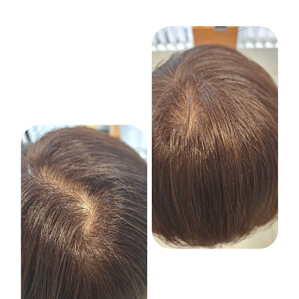 話題のトキカタ♪頭頂部編