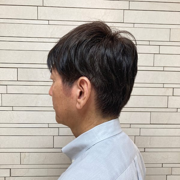 60代男性《アフター→ビフォー》