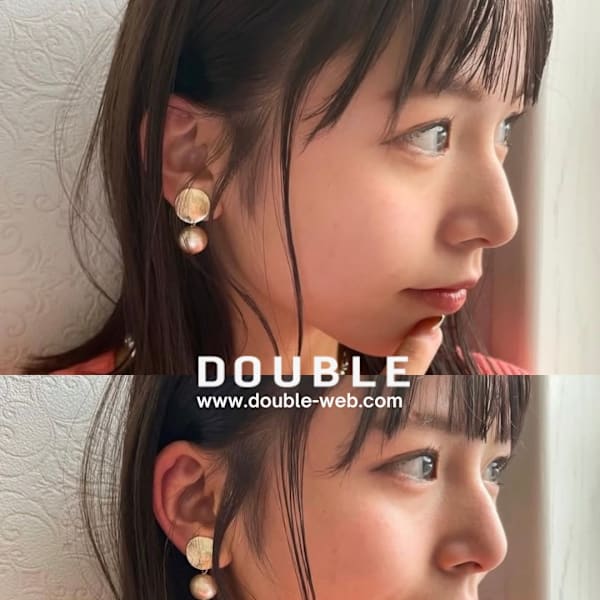 横顔まで美しいナチュラルミディアム|DOUBLE